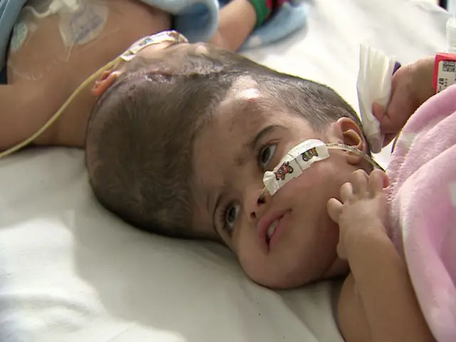 ኣብቲ ካልኣይ መጥባሕቲ ጸገም ኣጋጢምዎም