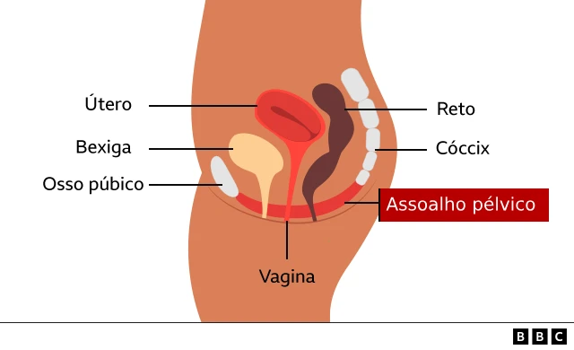 Diagrama anatômico da pelve feminina visto de lado. São identificados o útero, a bexiga, o reto, o cóccix, o osso púbico e a vagina. Uma faixa vermelha na base indica o assoalho pélvico, responsável por sustentar esses órgãos.