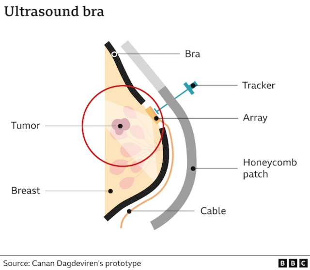ఈ డివైజ్ ఎలా పనిచేస్తుందో తెలిపే గ్రాఫ్