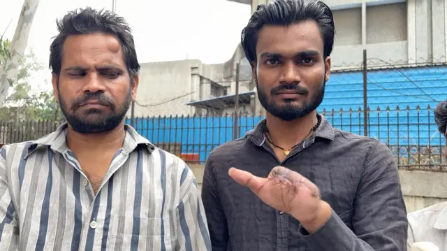 जखमी कामगार