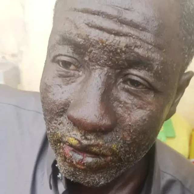 Visage d'un pêcheur malade