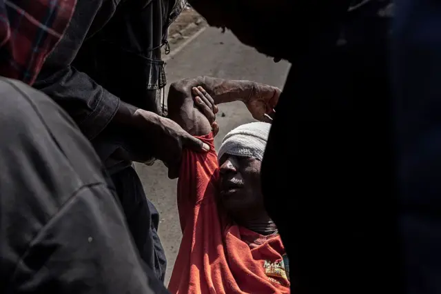 Un manifestant blessé est porté par d'autres manifestants lors des manifestations de la journée Saba Saba dans la banlieue de Nairobi, le 7 juillet 2025.