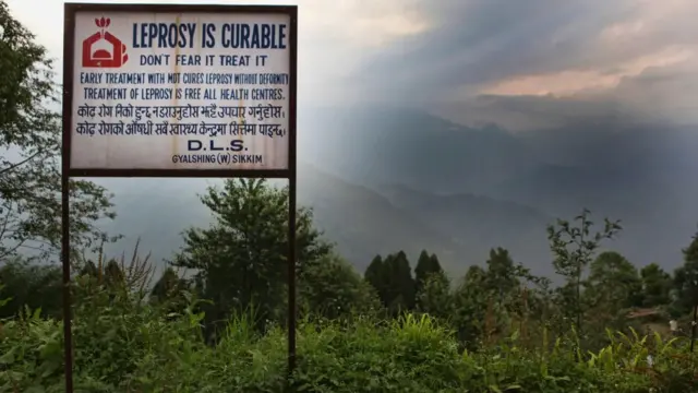 Kusta: Penyakit kuno misterius yang belum bisa dipecahkan para ilmuwan