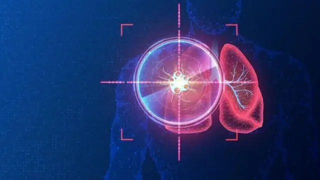 క్యాన్సర్ థెరపీ