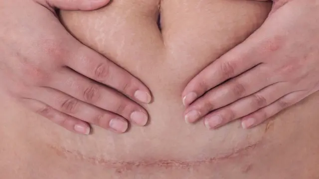 ਸੰਕੇਤਕ ਤਸਵੀਰ