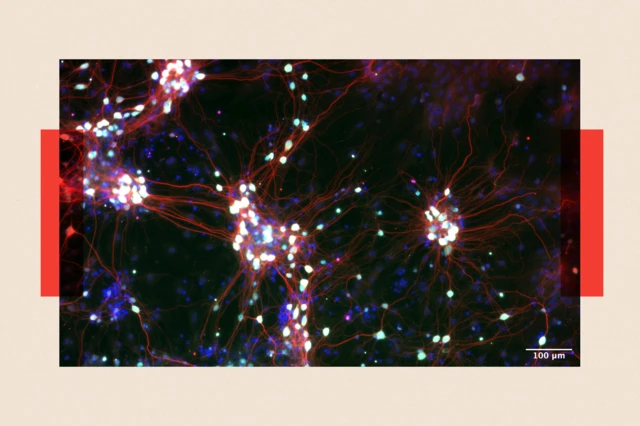 Gros plan sur les cellules nerveuses 