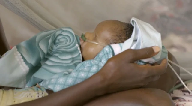 ቤኒቱ ያለ ሆስፒታል ውስጥ አንድ እናት የወለደችው ልጅ አፍና አፍንጫ የተጣበቀ ነው።
