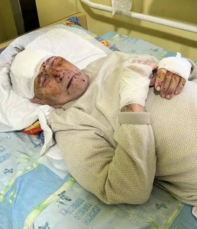 Экинчи дүйнөлүк согуштун ардагери жарадар болду
