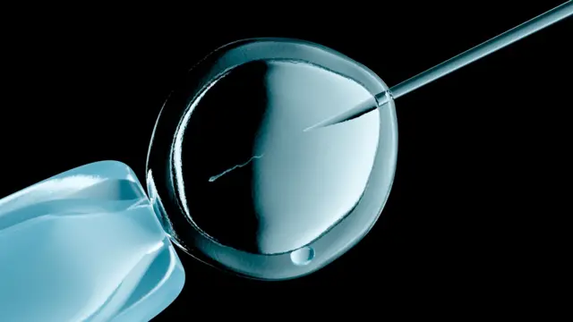 IVF சிகிச்சை முறை 