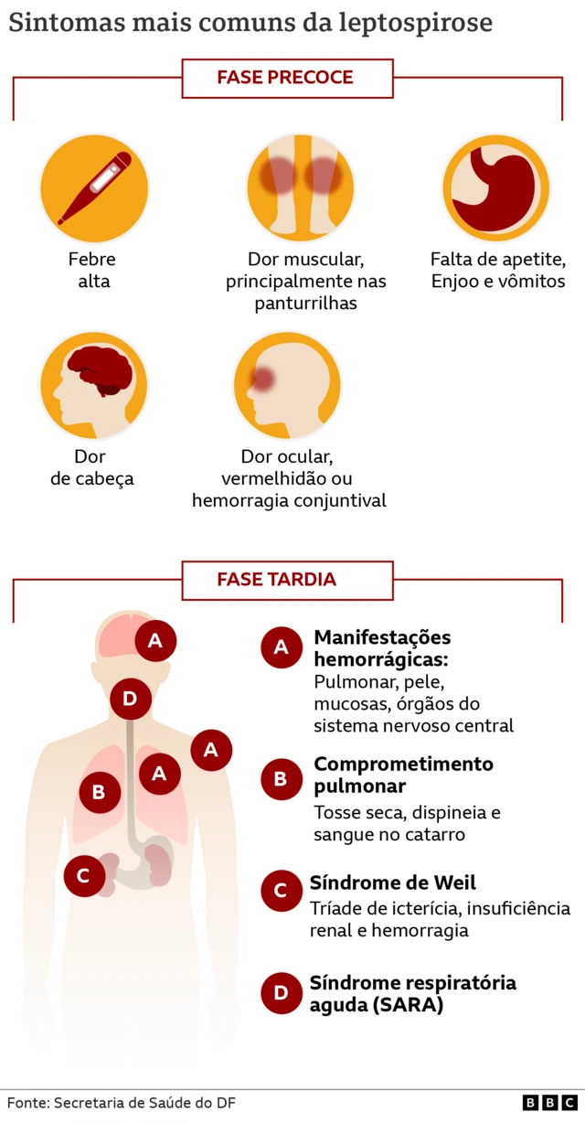 grafico mostra os sintomas da leptospirose