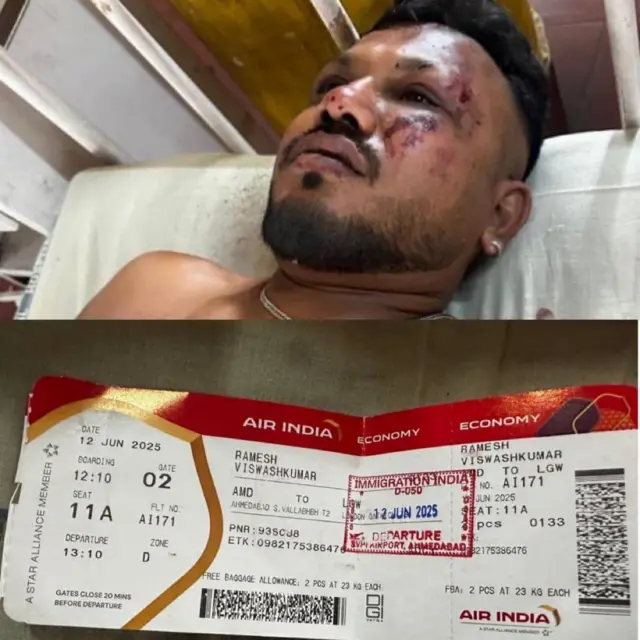 Višvaškumar Rameš, jedini preživeli iz aviona Er Indija koji se srušio na grad Ahmedabad odmah po poletanju za London