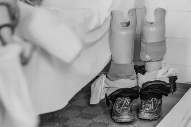 صورة بالأبيض والأسود لأطراف صناعية لأرجل أطفال.