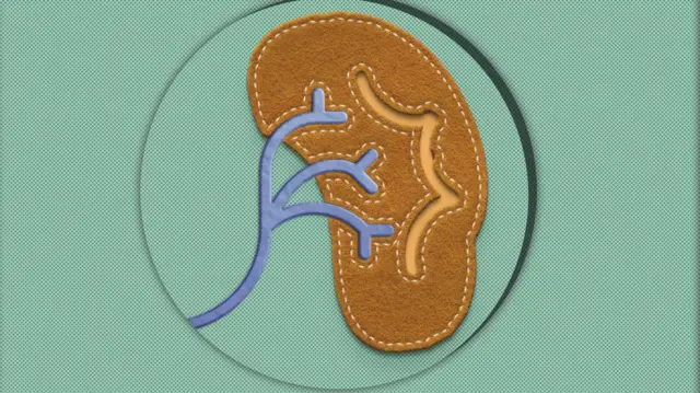भारत में किडनी बिक्री को लेकर चिंता