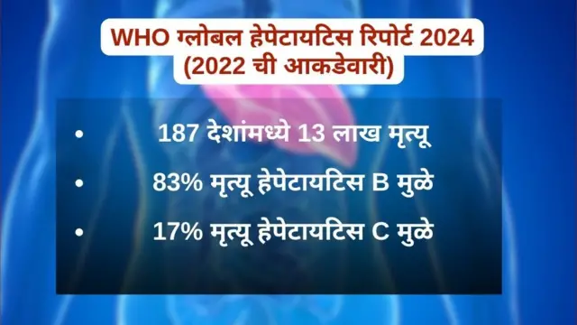 हेपेटायटिस