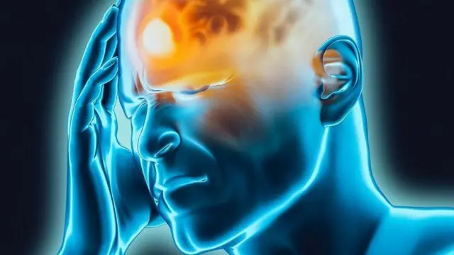 Image illustrant la céphalée aiguë 