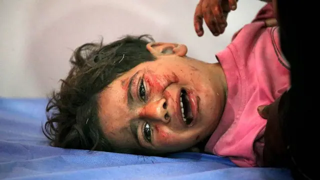 Uma criança ferida em ataque israelense sendo atendida no Hospital Al Awda, em Gaza, em maio de 2025