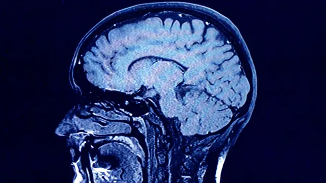 மனித மூளை முதிர்ச்சி அடைவதைத் தடுக்க வழி தேடும் விஞ்ஞானிகள் - என்ன கிடைத்தது?