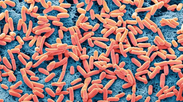 E. coli bakterisi. 