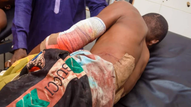Eeyan kan to farapa nibi idaluru to waye ni ipinlẹ Osun sun sori ibusun nile iwosan pẹlu oniruuru ọgbẹ ara wọn ti wọn so bandeji mọ