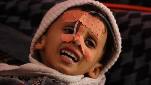 اليمن