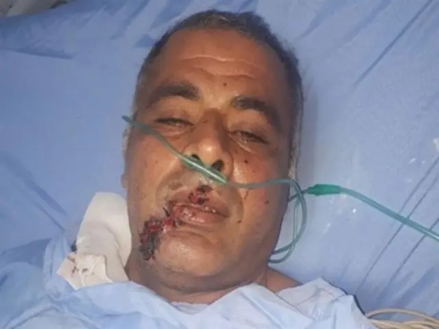 محیط بان