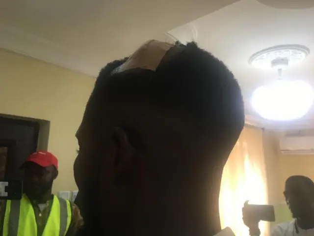 Anoda SDP agent wey dem attack