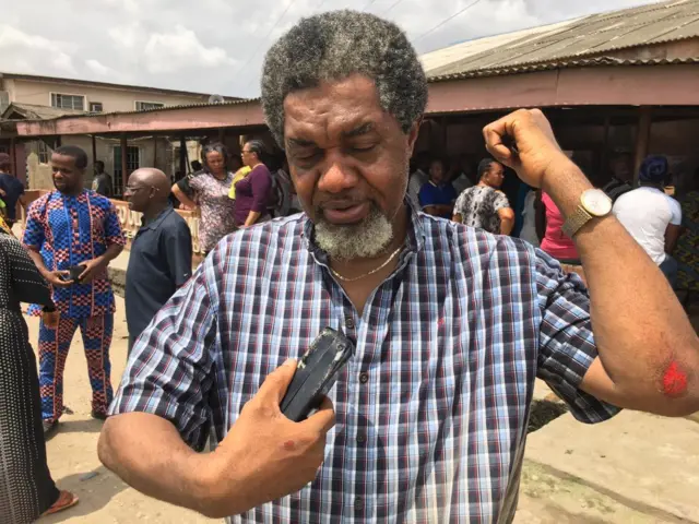 Ralph Nwadike gba ọgbẹ