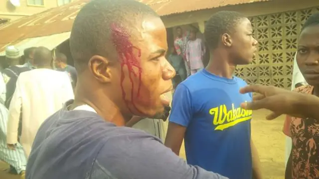 Kwara agent