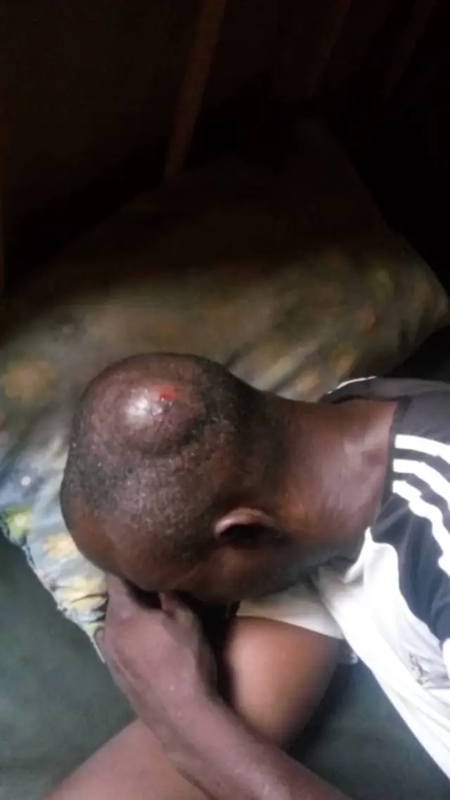 Ẹni ti wọn fọ lori