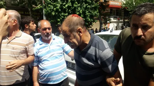 Polis müdahalesi sonucu bir kişi kafasından yaralandı