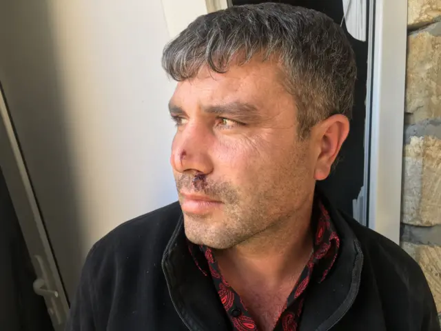 Gəncəyə hücum, raket, cəbhədə döyüşlər