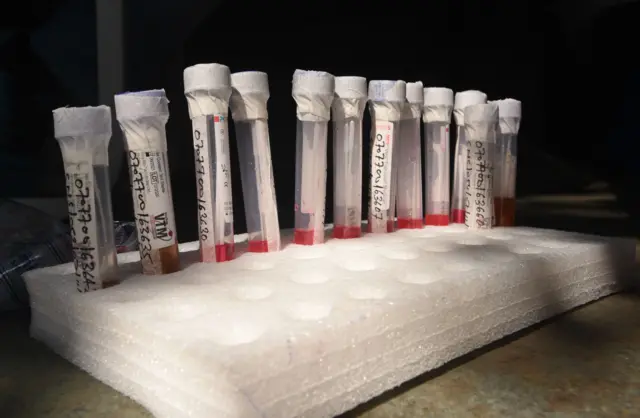 PCR testleri