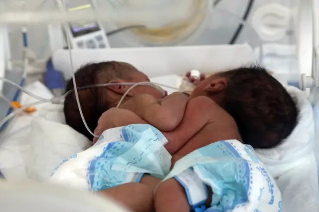 Tagwayen da aka haifa a Yemen a manne da juna