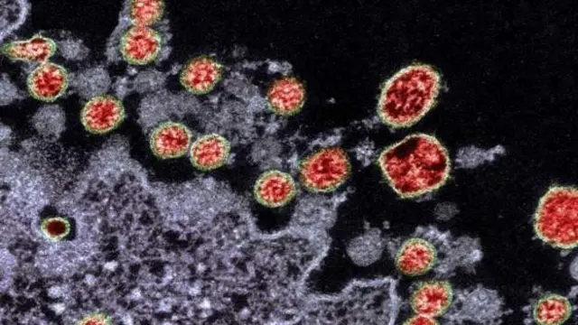 daukacin masana a kasar sun amince a yi amfani da Chloroquine phosphate domin maganin cutar Covid-19 virus