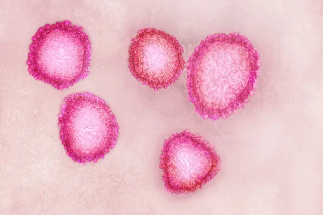 virus