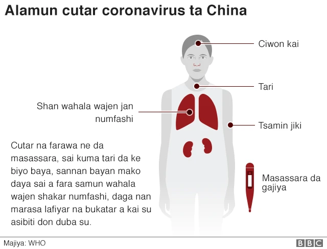 Alamomin cutar coronavirus