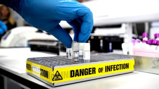 கொரோனா சோதனை