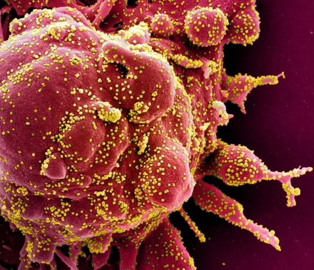 Coronavirus