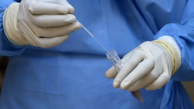 कोरोना वायरस