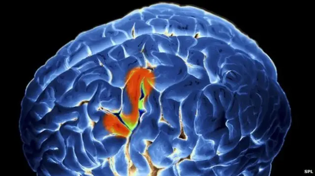 ሓንጎል ደቂ-ሰባት