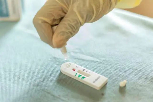 Nyocha ọrịa coronavirus