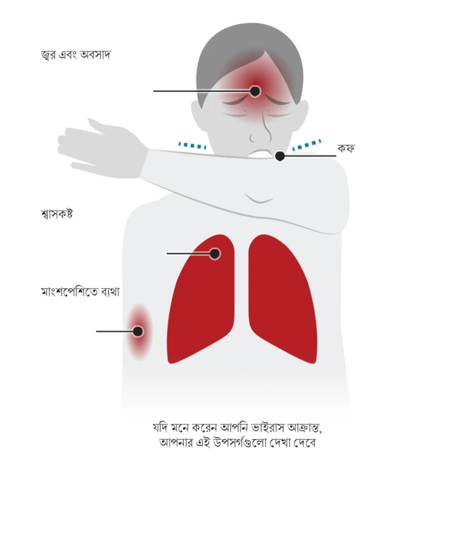 করোনাভাইরাসের উপসর্গ