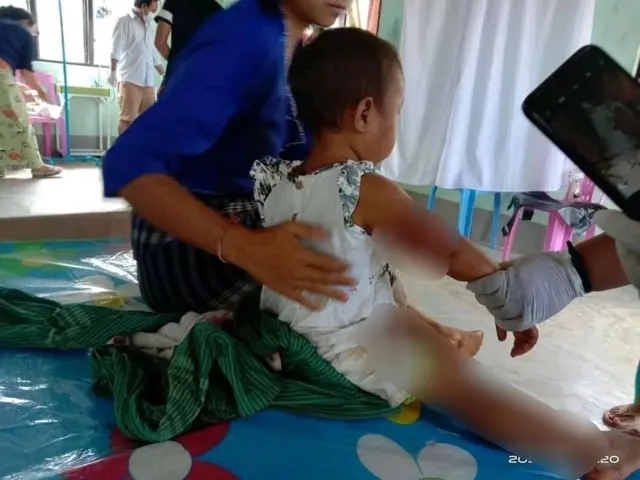 လက်နက်ကြီးထိမှန်လို့ ဒဏ်ရာရသူတွေထဲမှာ ကလေးငယ် ၂ ဦးလည်းပါဝင်