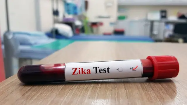 ज़ीका वायरस