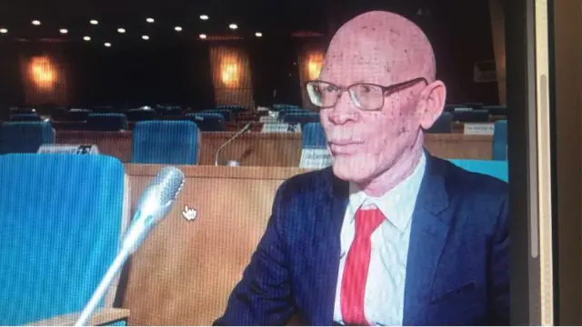 Overstone Kondowe, Mmalawi wa kwanza mwenye ualbino kuchaguliwa kuwa mbunge
