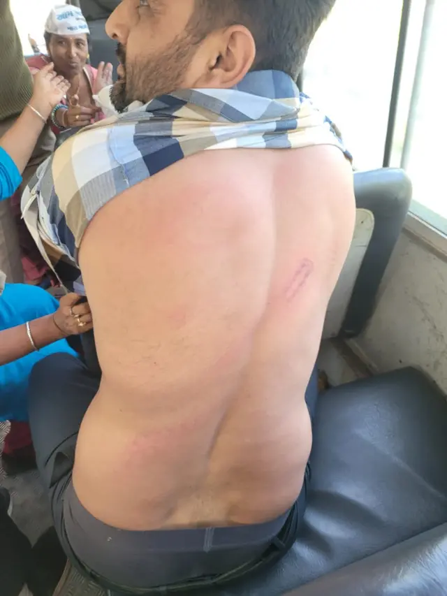 ગોપાલ ઇટાલિયા