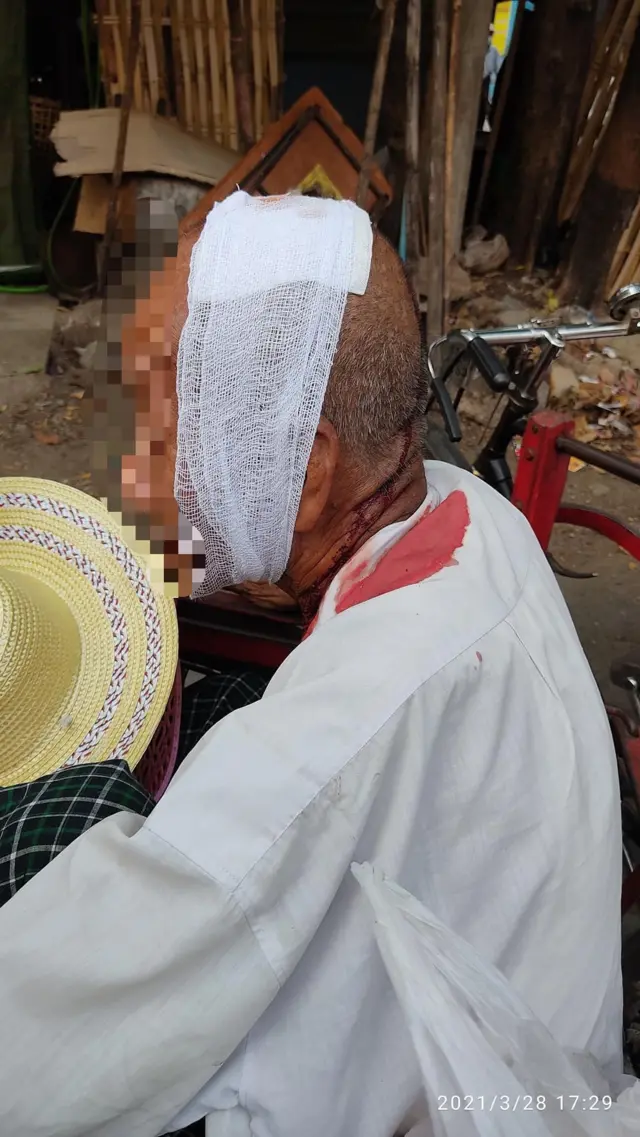 စစ်ကောင်စီတပ်တွေက ရပ်ကွက်တွေထဲ အထိ  လိုက်လံပစ်ခတ်မှုတွေ နေရာအနှံ့ ဖြစ်ပေါ်နေ