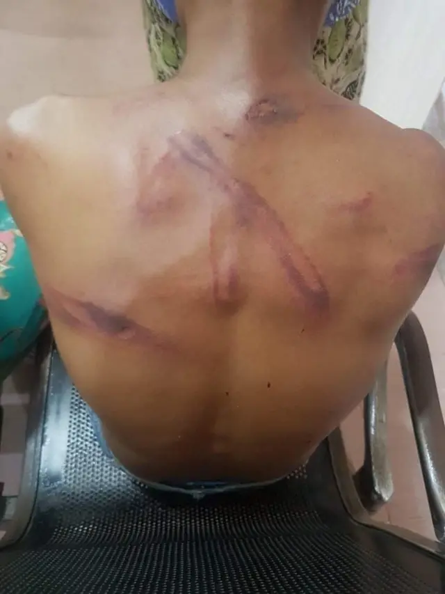 Myeik strike