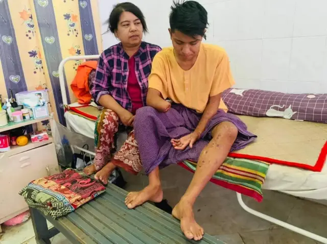 စစ်ဆေးရုံမှာမိခင်နဲ့အတူတွေ့ရတဲ့ ကိုလျှံဖြိုးအောင်ပါ။ ညာဘက် ခြေထောက်က ကျောက်ပတ်တီးတွေဖြည်အပြီးမှာ သေနတ်ကျည်ဆန်ထိမှန်ဒဏ်ရာတွေကိုတွေ့မြင်နေရတာဖြစ်ပါတယ်။