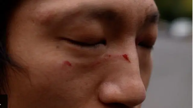 Nwoke China akụpere imi